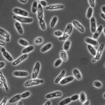 Brettanomyces en la cerveza: Un mundo de aromas y sabores únicos