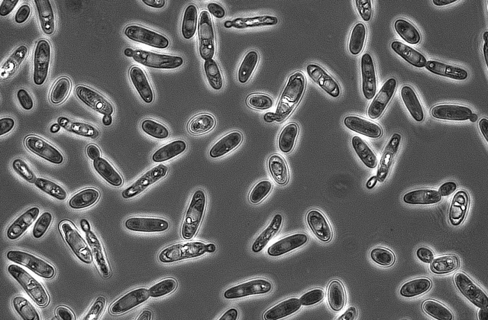Brettanomyces en la cerveza