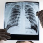 Cerveza y salud pulmonar: ¿Qué dice la ciencia sobre sus efectos?