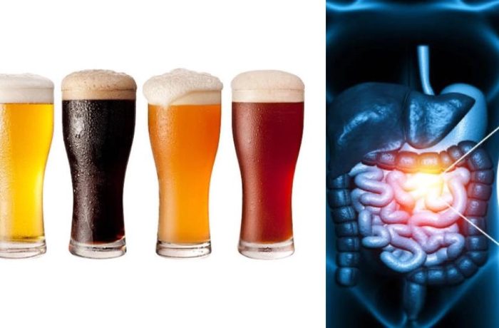 Cartilla de colores de cerveza para detectar senales de cancer de colon